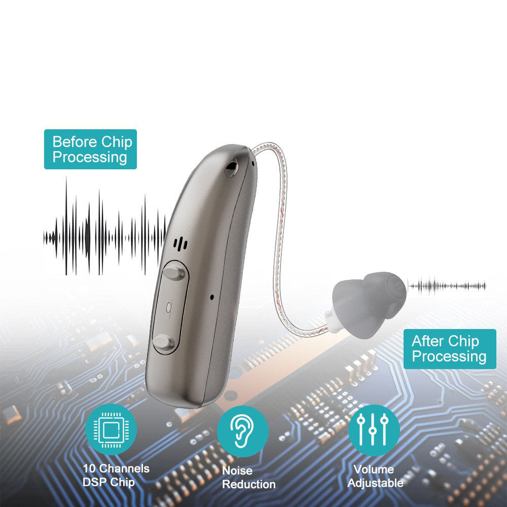 🔥 Smart Sound Support - Hear Clearly Again | 60% OFF