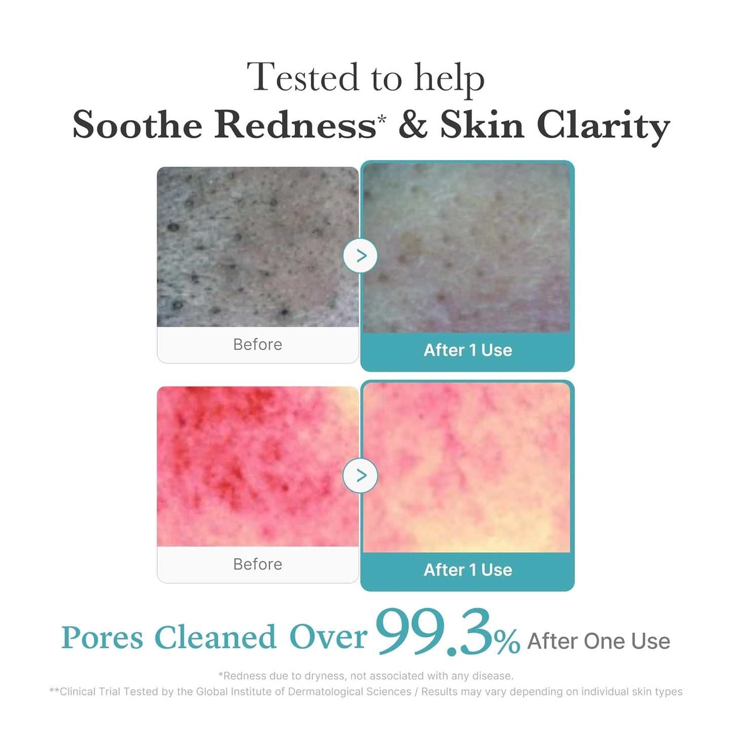 Azelaic Acid Niacinamide Deep Clean Foam Cleanser