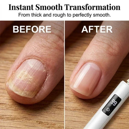 💅Professional Ultra-Safe LED Electric Nail Grinder